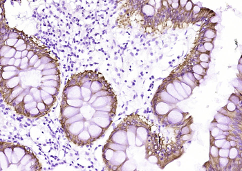 CK20 (ready to use) Mouse Monoclonal Antibody
