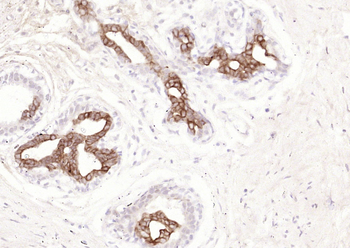 Cytokeratin 15 (ready to use) Mouse Monoclonal Antibody