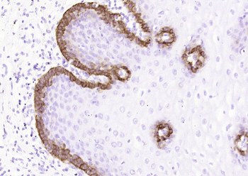 Cytokeratin 15 (ready to use) Mouse Monoclonal Antibody