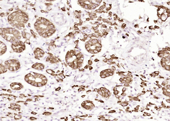 Pan Cytokeratin (ready to use) Mouse Monoclonal Antibody