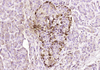 SSTR4 Rabbit Polyclonal Antibody