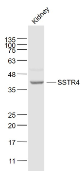 SSTR4 Rabbit Polyclonal Antibody