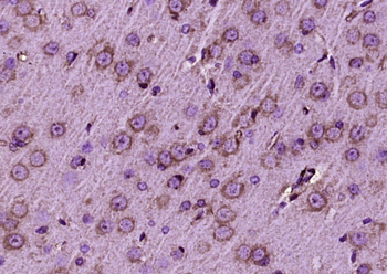 TrkB Rabbit Polyclonal Antibody