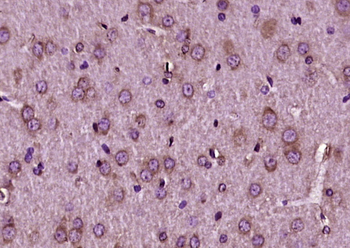 TrkB Rabbit Polyclonal Antibody