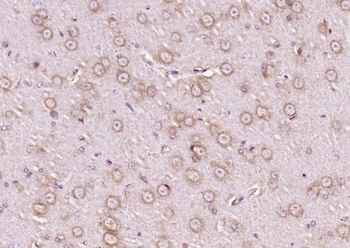STIM1 Rabbit Polyclonal Antibody