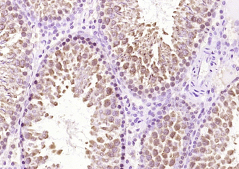 STIM1 Rabbit Polyclonal Antibody