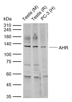 AHR Rabbit Polyclonal Antibody