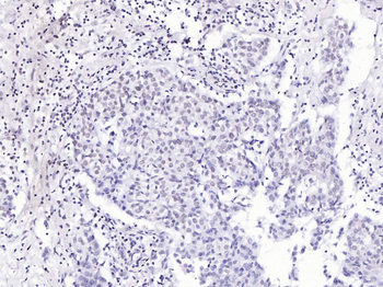 Phospho-BRCA1 (Ser1466) Rabbit Polyclonal Antibody