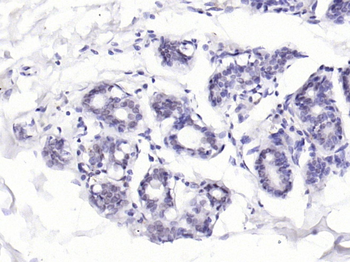 Phospho-BRCA1 (Ser1466) Rabbit Polyclonal Antibody
