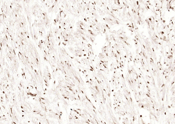 Phospho-BRCA1 (Ser1466) Rabbit Polyclonal Antibody