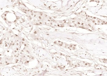 Phospho-BRCA1 (Ser1466) Rabbit Polyclonal Antibody