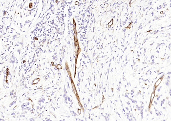 CD31 (ready to use) Mouse Monoclonal Antibody