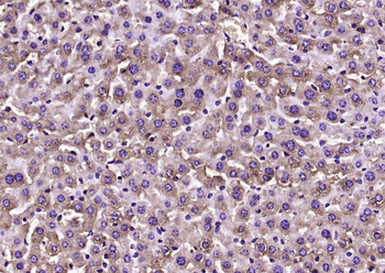 CA II Rabbit Polyclonal Antibody