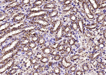 CA II Rabbit Polyclonal Antibody