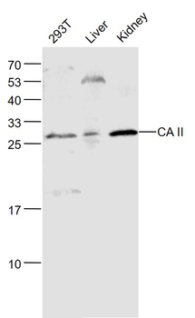 CA II Rabbit Polyclonal Antibody