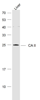 CA II Rabbit Polyclonal Antibody