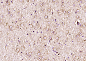 CK II beta Rabbit Polyclonal Antibody