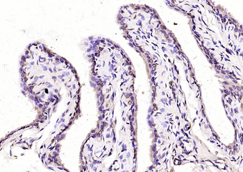 Axin1 Rabbit Polyclonal Antibody