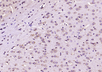 Nm23-H2/NME2 Rabbit Polyclonal Antibody