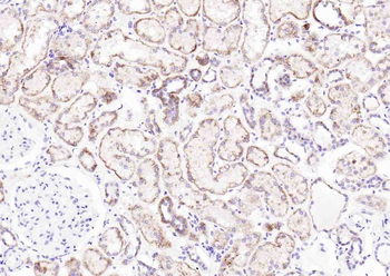 PRDX2 Rabbit Polyclonal Antibody