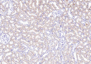 PRDX2 Rabbit Polyclonal Antibody