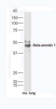 Beta-arrestin 1 + 2 Rabbit Polyclonal Antibody