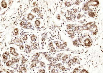 Estrogen Receptor α (ready to use) Mouse Monoclonal Antibody