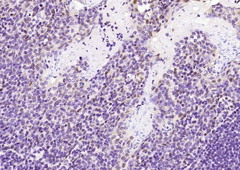 Estrogen Receptor α (ready to use) Mouse Monoclonal Antibody