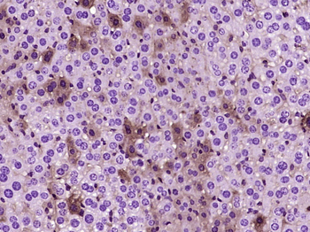 ANGPTL8 Mouse Monoclonal Antibody