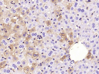 ANGPTL8 Mouse Monoclonal Antibody