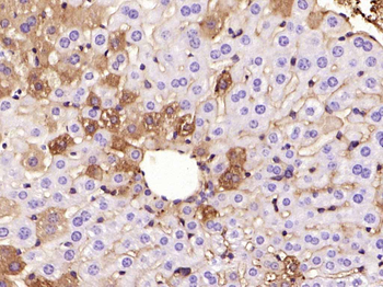 ANGPTL8 Mouse Monoclonal Antibody