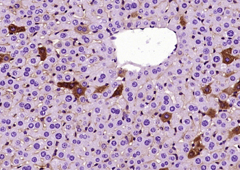 ANGPTL8 Mouse Monoclonal Antibody