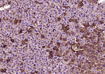 ANGPTL8 Mouse Monoclonal Antibody