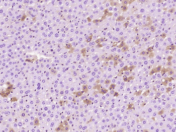 ANGPTL8 Mouse Monoclonal Antibody