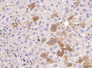ANGPTL8 Mouse Monoclonal Antibody