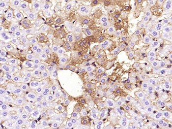 ANGPTL8 Mouse Monoclonal Antibody