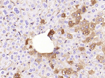 ANGPTL8 Mouse Monoclonal Antibody