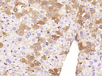 ANGPTL8 Mouse Monoclonal Antibody