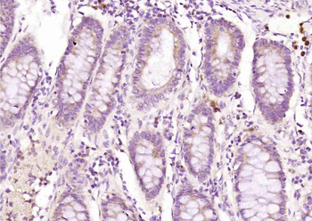 Exportin 1 Rabbit Polyclonal Antibody