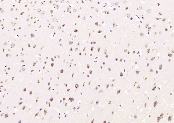 Exportin 1 Rabbit Polyclonal Antibody