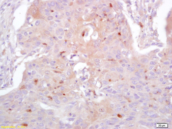 Exportin 1 Rabbit Polyclonal Antibody