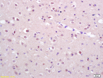 Exportin 1 Rabbit Polyclonal Antibody