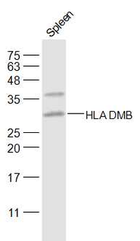 HLA-DPB1 Rabbit Polyclonal Antibody