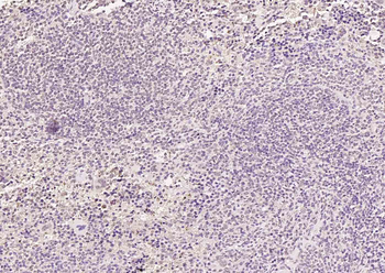 HSF1 Rabbit Polyclonal Antibody