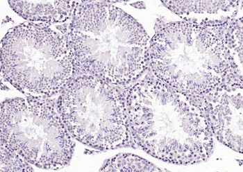 HSF1 Rabbit Polyclonal Antibody