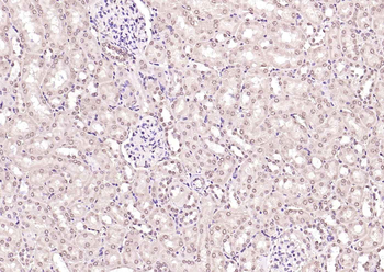 HSF1 Rabbit Polyclonal Antibody