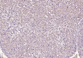 HSF1 Rabbit Polyclonal Antibody