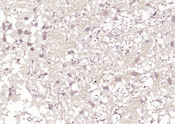 HSF1 Rabbit Polyclonal Antibody