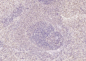 HSF1 Rabbit Polyclonal Antibody