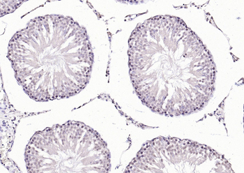 HSF1 Rabbit Polyclonal Antibody